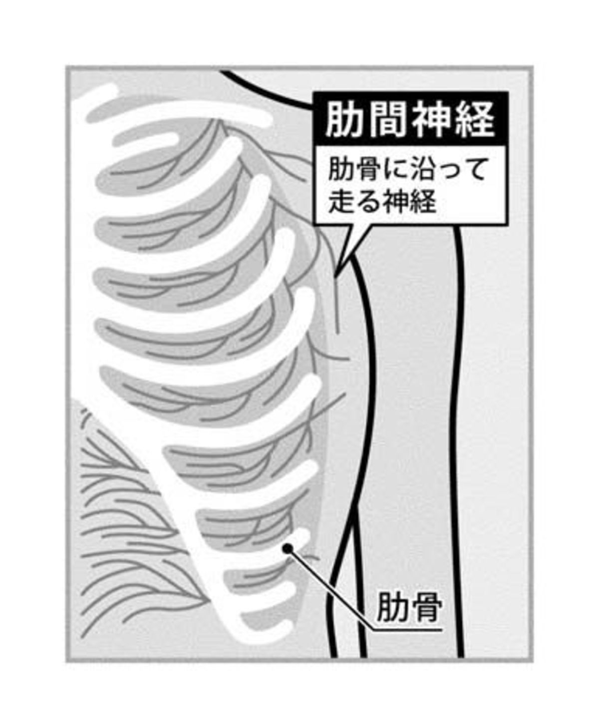 肋間神経痛 健康相談 徳島新聞電子版