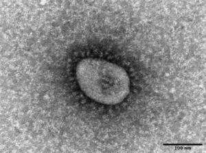 　新型コロナウイルスのオミクロン株の電子顕微鏡写真（国立感染症研究所提供）